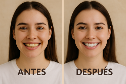 BLANQUEADOR DENTAL | WINNER